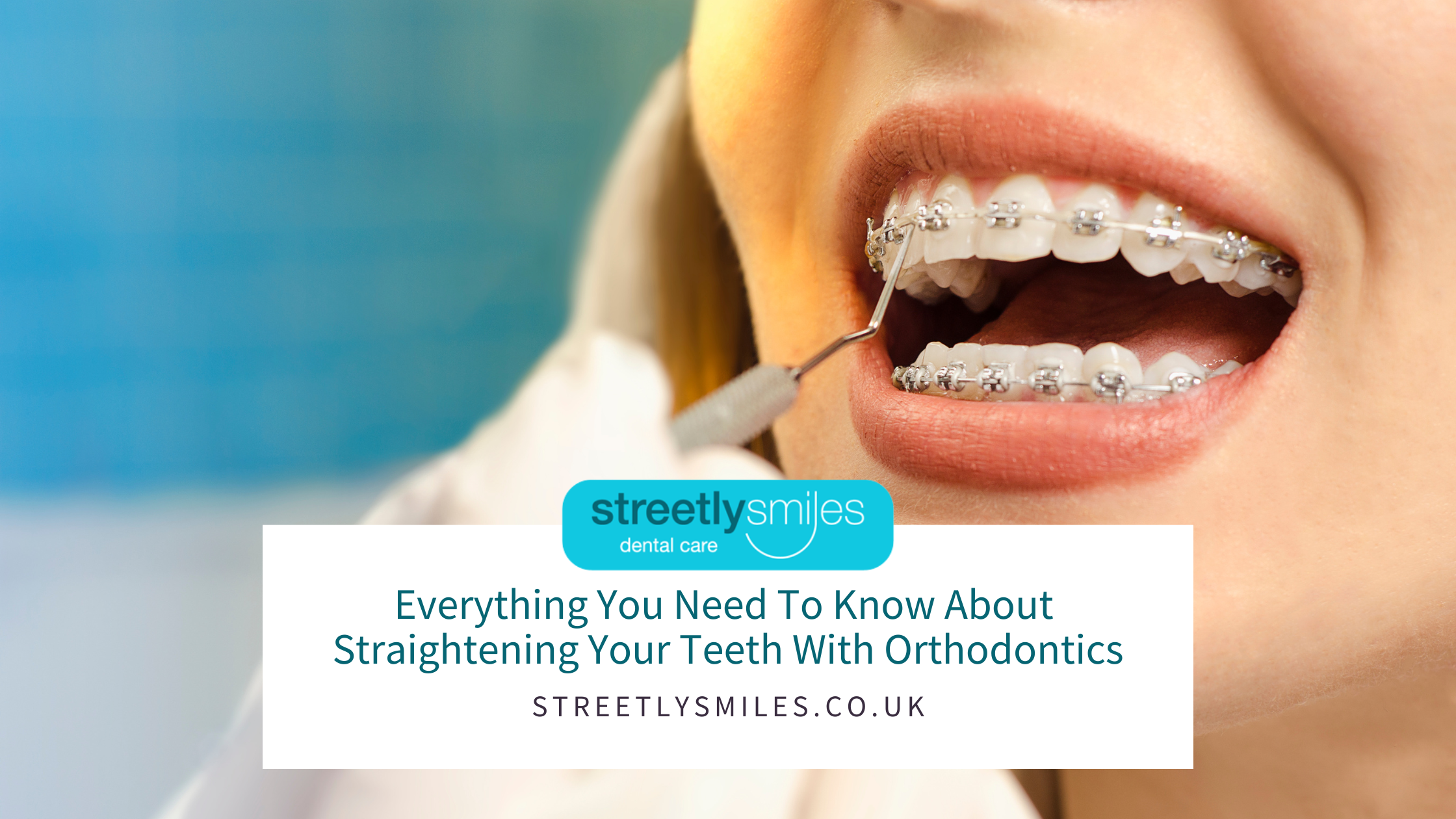 Are you in need of orthodontic treatment & what do you look for in an  orthodontist? - My Primary Dental